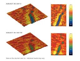 ALUMIER MD EverActive C&E® + Peptide (3 pakuotės) 3x15ml - Image 3